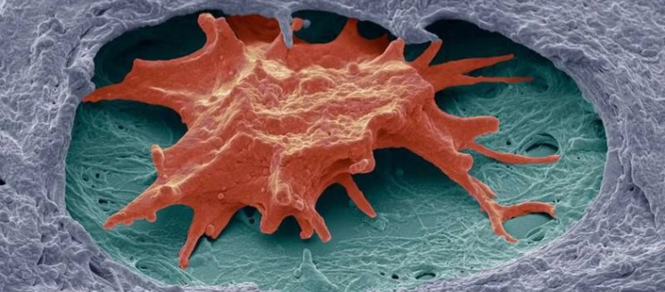 Αυτές οι θεραπευτικές τεχνικές χαρίζουν ποιότητα ζωής στις γυναίκες